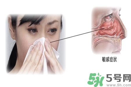 過敏性鼻炎的高發(fā)人群有哪些？如何預(yù)防過敏性鼻炎？