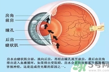 青光眼是什么？青光眼癥狀有什么？