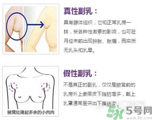 副乳是什么？副乳的危害