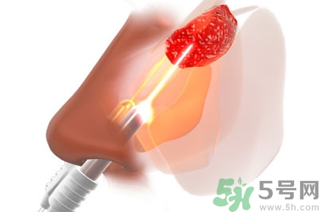 鼻咽癌的日常措施是什么？鼻咽癌注意的飲食有哪些？
