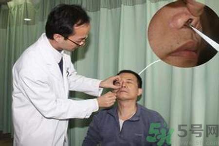 鼻咽癌的治療方法是什么？鼻咽癌可以用什么藥物治療？