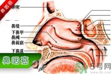 鼻咽癌的發(fā)病因素是什么？鼻咽癌的并發(fā)癥有哪些？