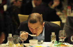 男人禿頂會(huì)遺傳嗎？男人禿頂是腎虛嗎？