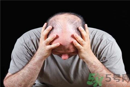 脫發(fā)的治療方法是什么？脫發(fā)的藥物治療有哪些？