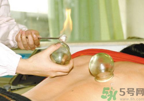拔火罐和拔氣罐哪個(gè)好？拔火罐和拔氣罐的區(qū)別