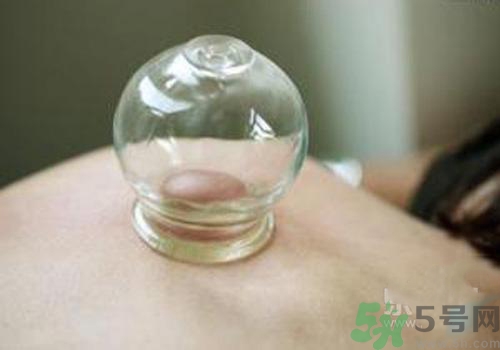 拔火罐和拔氣罐哪個(gè)好？拔火罐和拔氣罐的區(qū)別