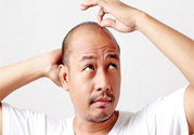 脫發(fā)的高發(fā)人群有哪些？如何預(yù)防脫發(fā)？