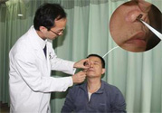 鼻咽癌的發(fā)病因素是什么？鼻咽癌的并發(fā)癥有哪些？