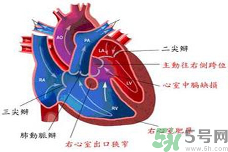 先天性心臟病需要注意什么？