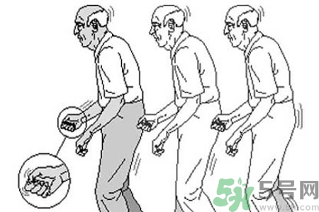 帕金森要注意哪些措施？帕金森的飲食需注意什么？