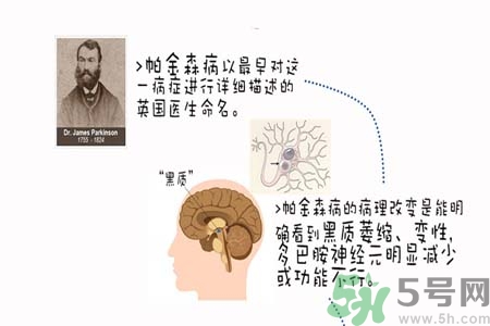 帕金森的治療方法有哪些？