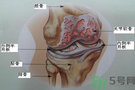 預(yù)防骨病需要注意哪些姿勢(shì)？秋季預(yù)防骨病的方法有哪些？