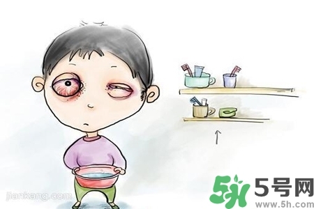寶寶為什么會(huì)感染紅眼??？寶寶患紅眼病如何治療？