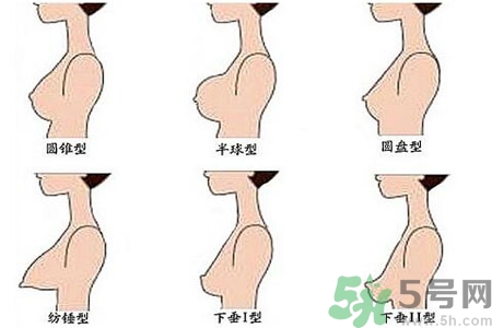 ?女性乳房下垂的原因是什么？女性乳房下垂的分類有哪些？
