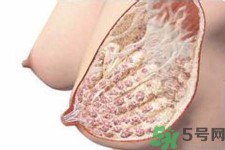 乳腺增生治療方法是什么？乳腺增生的檢查方法有哪些？