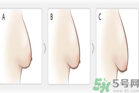 胸部松弛的原因是什么？胸部松弛該怎么辦？