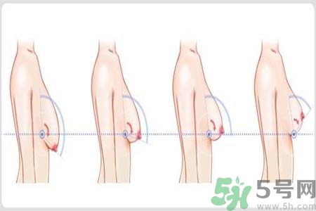 胸部松弛的原因是什么？胸部松弛該怎么辦？