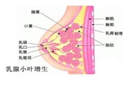 乳腺增生治療方法是什么？乳腺增生的檢查方法有哪些？