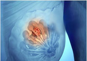乳房有硬塊正常嗎？乳房有腫塊怎么回事？
