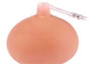乳頭內(nèi)陷可以拔罐嗎？乳頭內(nèi)陷需要手術(shù)治療嗎？