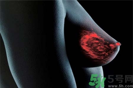 乳房上有硬塊怎么辦？乳房有硬塊的病因是什么？