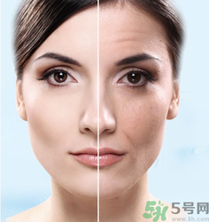 什么是3D液態(tài)拉皮？3D液態(tài)拉皮效果怎么樣？