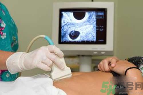 孕婦做b超要空腹嗎？孕婦做b超要不要空腹？