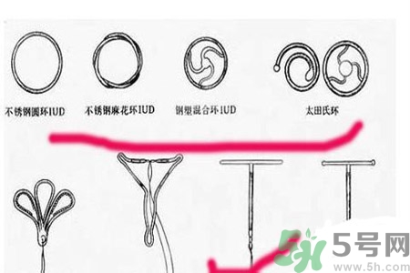 什么是宮內(nèi)節(jié)育器？放置宮內(nèi)節(jié)育器為什么能避孕？