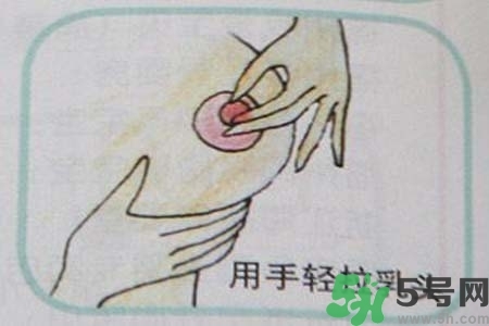 乳頭內(nèi)陷怎么矯正？乳頭內(nèi)陷矯正方法是什么？