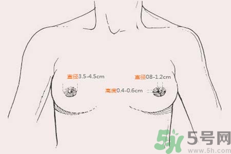 乳頭內(nèi)陷能不能喂奶？乳頭凹陷怎樣哺乳？