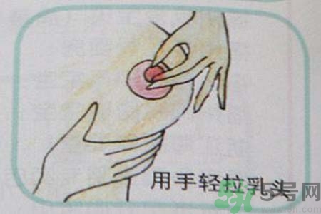 乳頭內(nèi)陷可以拔罐嗎？乳頭內(nèi)陷需要手術(shù)治療嗎？