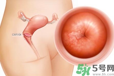 陰道出血癥狀有哪些？陰道出血需注意什么問(wèn)題？
