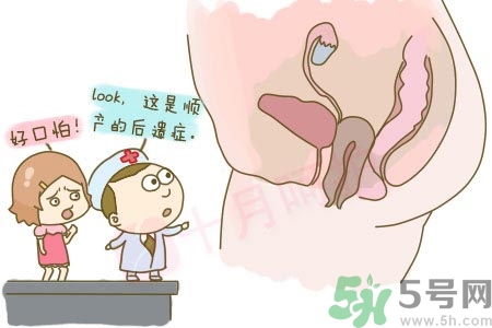 陰道松弛有什么危害？?陰道松弛恢復(fù)的方法有哪些？