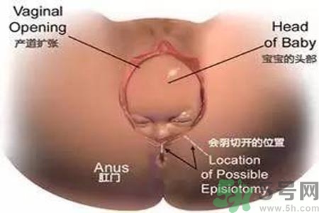 陰道松弛有什么危害？?陰道松弛恢復(fù)的方法有哪些？