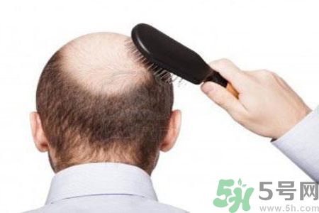 男性衰老的年齡段是什么？各年齡段男性抗衰老法則