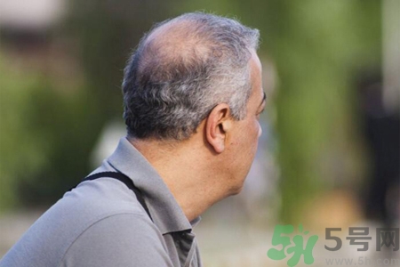 男性衰老的征兆有哪些？男性10個(gè)難以逆轉(zhuǎn)的衰老征兆