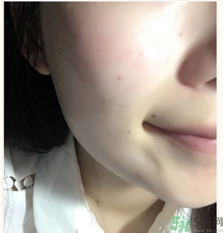 麗得姿面膜適合孕婦可以用嗎？麗得姿面膜哪些孕婦可以用？