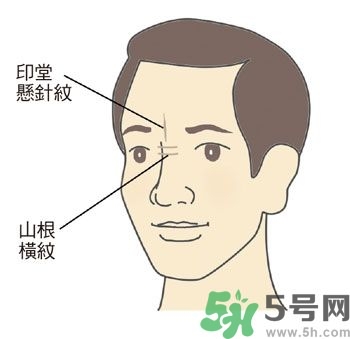 耳垂上有豎紋是怎么回事？山根有橫紋是什么病？