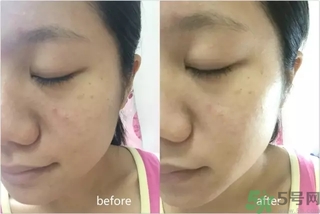 rilastil面膜使用方法 維納斯蒂爾面膜怎么用？
