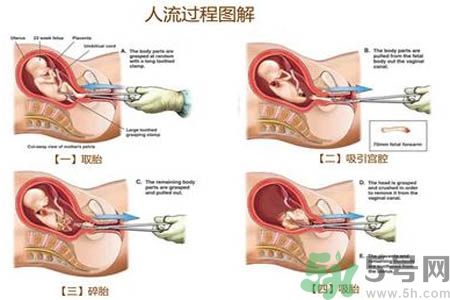 人流后怎么調(diào)養(yǎng)身體？人流后飲食需注意什么？