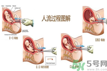 人流后怎么調(diào)養(yǎng)身體？人流后飲食需注意什么？