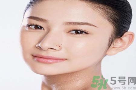 太陽(yáng)穴長(zhǎng)痘怎么辦？如何祛除太陽(yáng)穴上的痘痘？