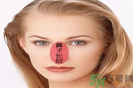 鼻子兩側長痘怎么辦？鼻子兩側長痘怎么回事？