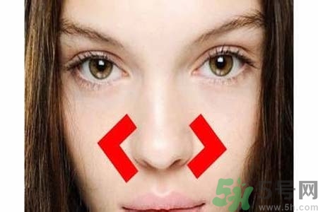 鼻子兩側長痘怎么辦？鼻子兩側長痘怎么回事？