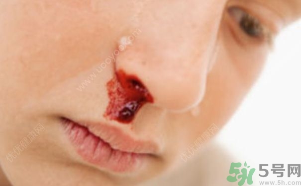 15歲男孩可以刮胡子嗎？15歲男孩經常流鼻血怎么回事？
