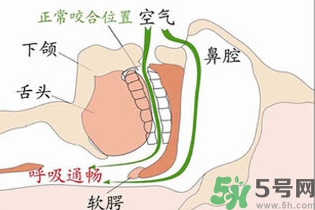 鼻子紅是什么原因？鼻子紅怎么辦？