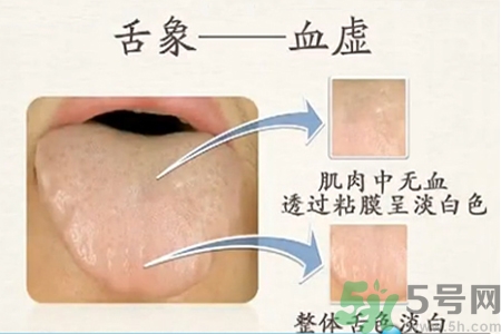 血虛的癥狀是什么？血虛的表現(xiàn)有哪些？
