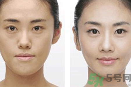 激光縮毛孔多少錢(qián)一次？激光縮毛孔一個(gè)療程多少錢(qián)？