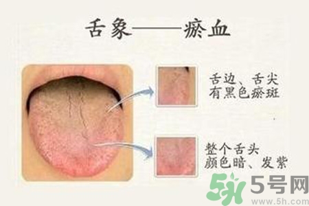 血瘀體質(zhì)吃什么？血瘀體質(zhì)怎么調(diào)理？