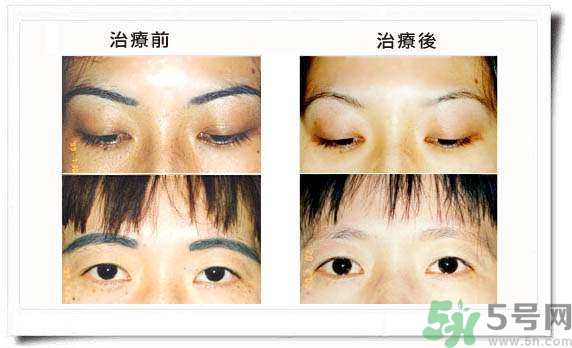 紋眉毛有什么危害？紋眉后注意事項